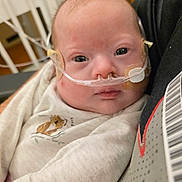 Emerysn is registered to the contest to win money with this photo: baby, infant, nasal_cannula, medical_tape, white_clothing, person, close_up, face, expression, hospital, healthcare, resting, holding, cute, soft_texture, animal_print, young_child, skin, head, eyes