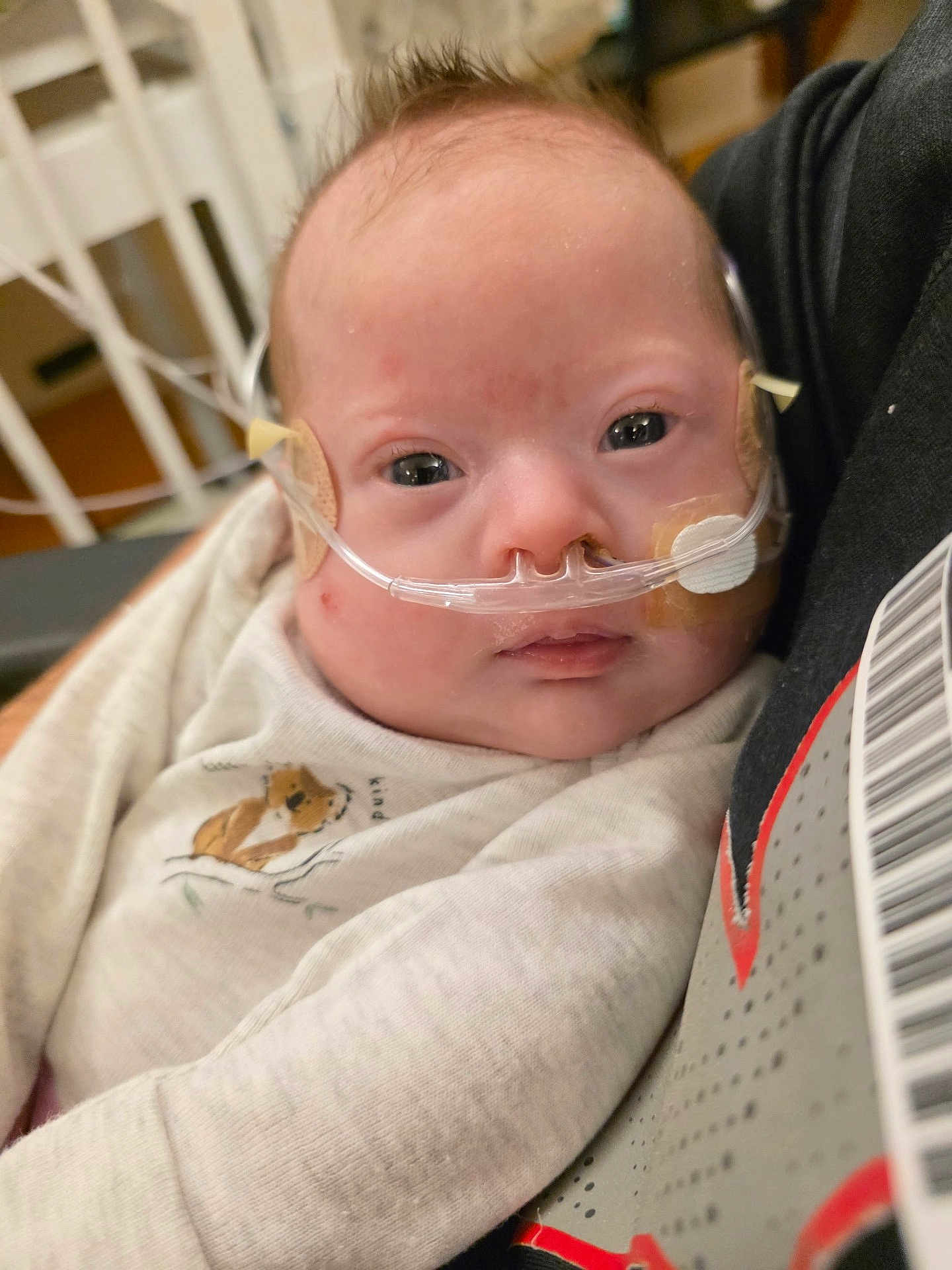 Emerysn is registered to the contest to win money with this photo: baby, infant, nasal_cannula, medical_tape, white_clothing, person, close_up, face, expression, hospital, healthcare, resting, holding, cute, soft_texture, animal_print, young_child, skin, head, eyes