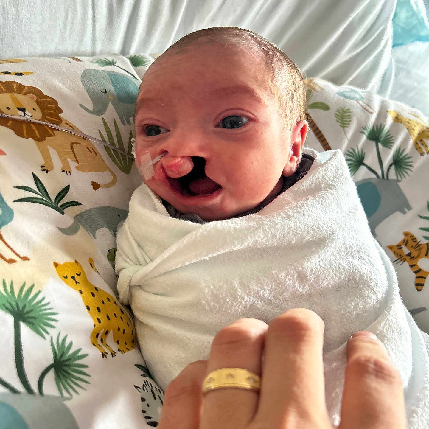 Ruger joined the competition — help win amazing prizes! baby, newborn, infant, wrapped, blanket, cleft_lip, nasal_tube, hand, ring, pillow, animal_print, lion, elephant, tiger, cheetah, plant, indoor, portrait, medical, care