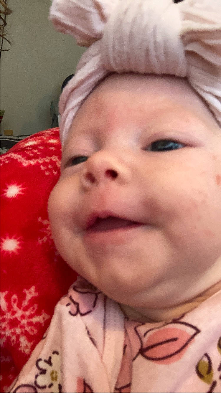 Estella joined the competition — help win amazing prizes! baby, cheek, chin, ear, eye, eyebrow, eyelash, forehead, hairstyle, happy, human_body, iris, jaw, lip, mouth, nose, person, pink, skin, smile
