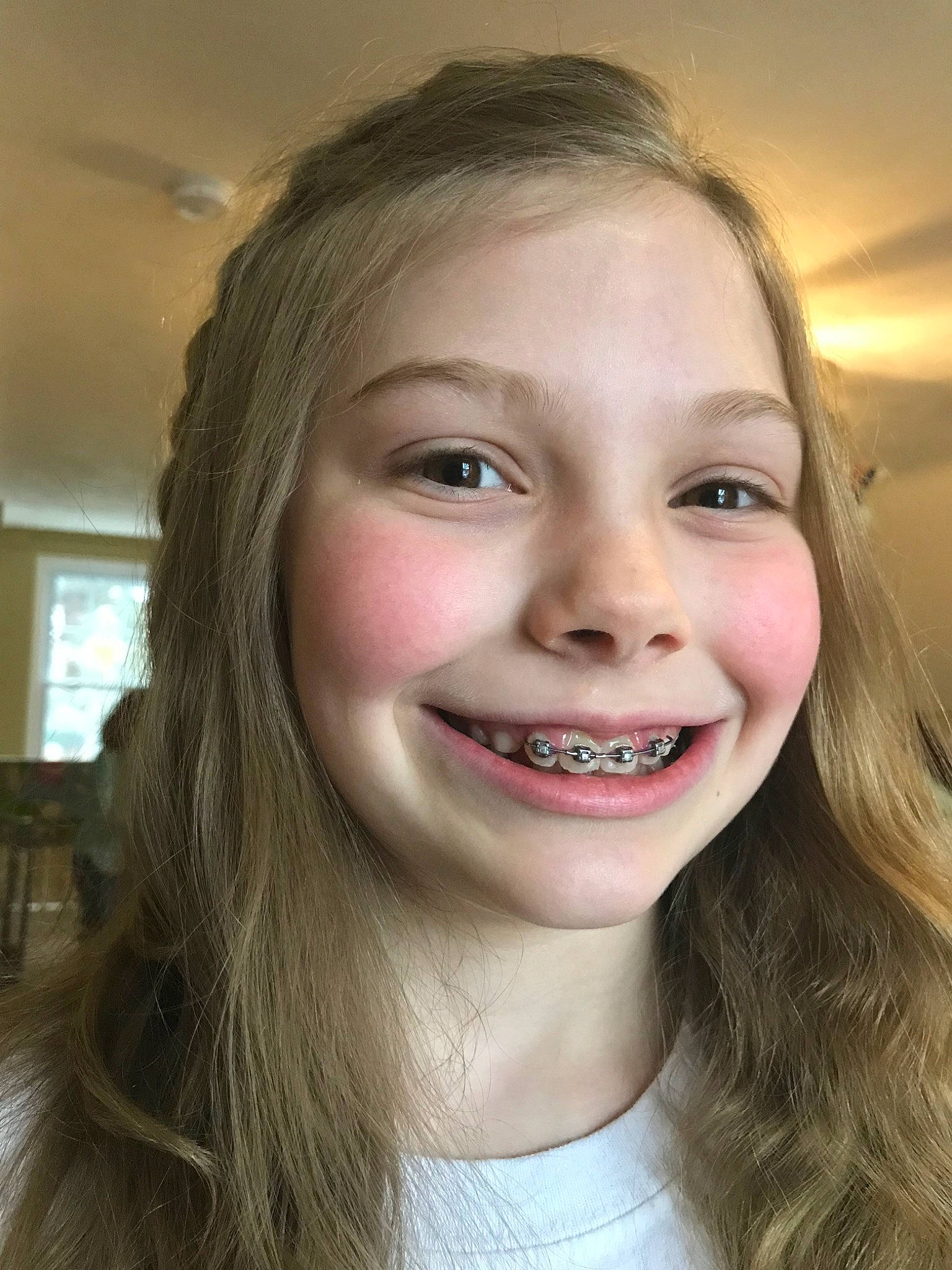 Genevieve joined the competition — help win amazing prizes! cheek, chin, eyebrow, face, facial_expression, forehead, fun, hair, hairstyle, head, human_body, jaw, joy, laugh, lip, mouth, nose, organ, person, skin