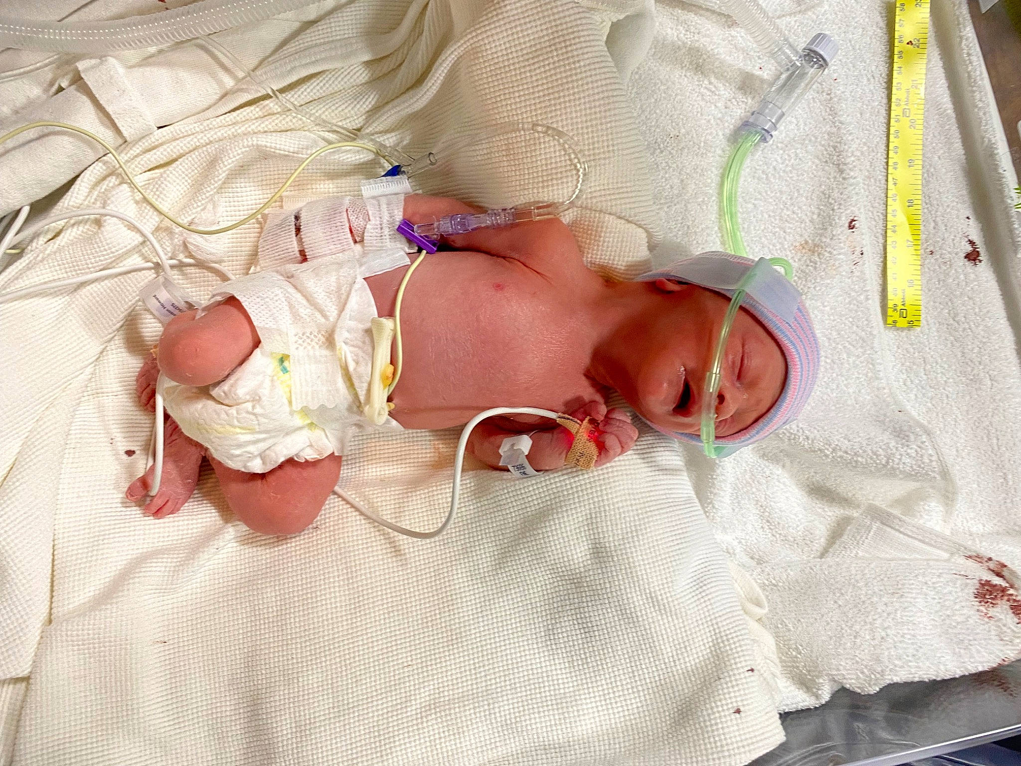 Jaxson joined the competition — help win amazing prizes! baby, baby_products, baby_safety, baby_sleeping, baby_toddler_clothing, bedding, bedtime, child, comfort, event, eye, eyelash, human_body, linens, nap, pattern, person, product, room, textile