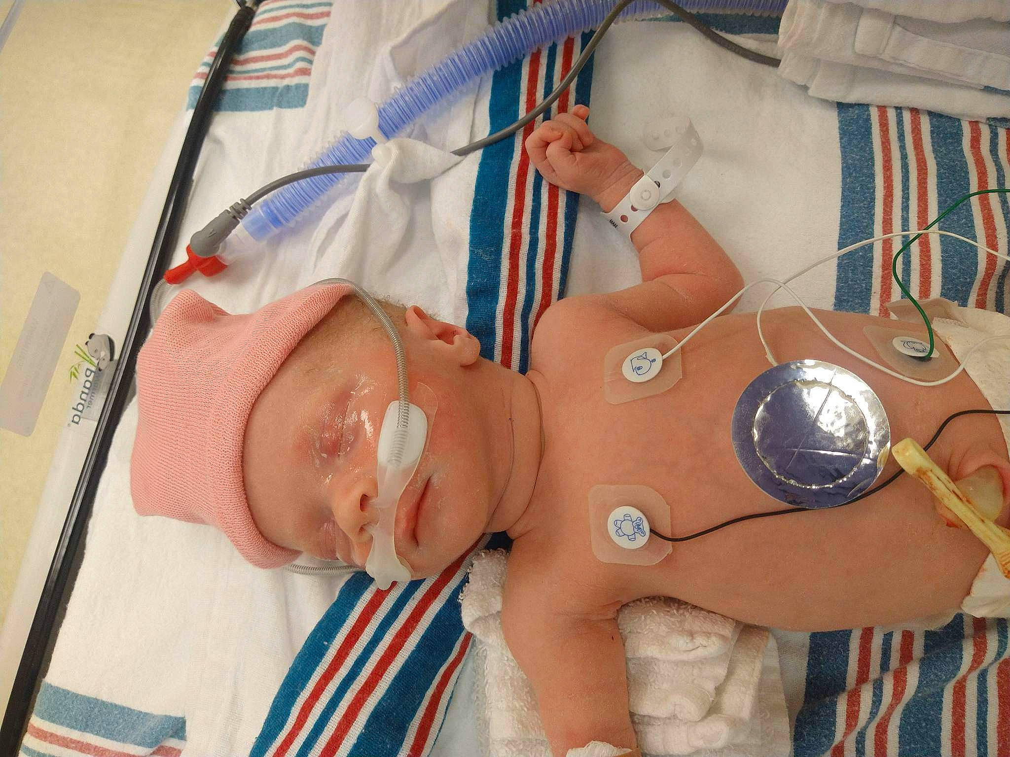 Cadence is registered to the contest to win money with this photo: abdomen, baby, baby_products, baby_toddler_clothing, chest, child, comfort, finger, flesh, health_care, hospital, medical_procedure, patient, person, service, skin, textile, thumb, toddler, trunk