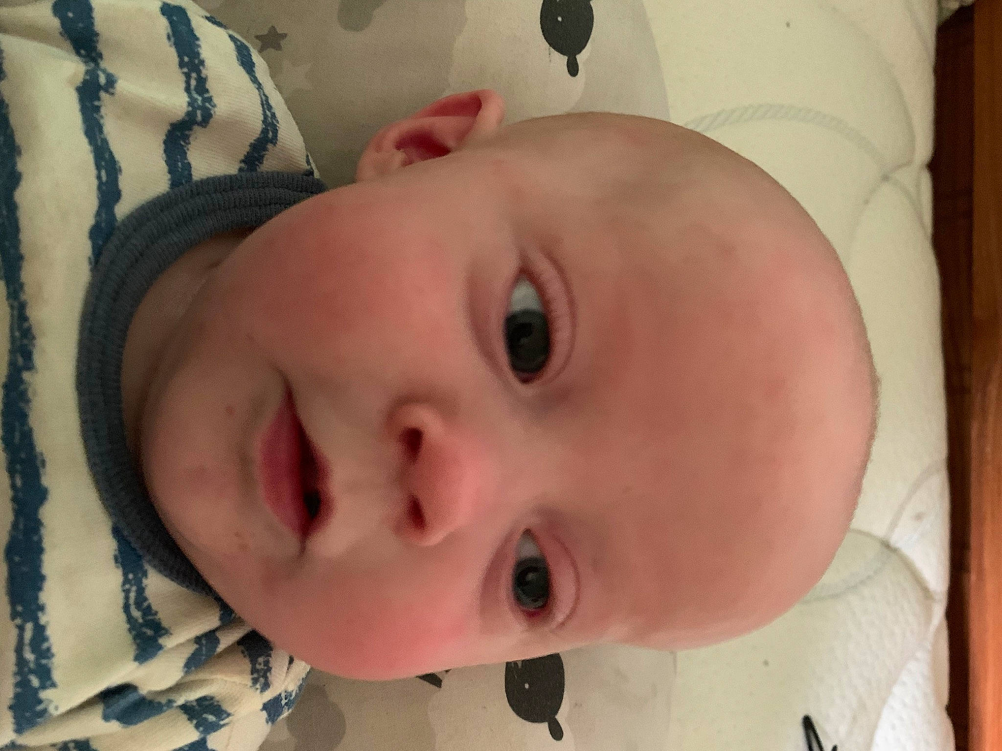 Baylan joined the competition — help win amazing prizes! baby, baby_toddler_clothing, cheek, chin, ear, eye, eyebrow, eyelash, face, facial_expression, forehead, head, iris, lip, mouth, nose, organ, person, skin, smile