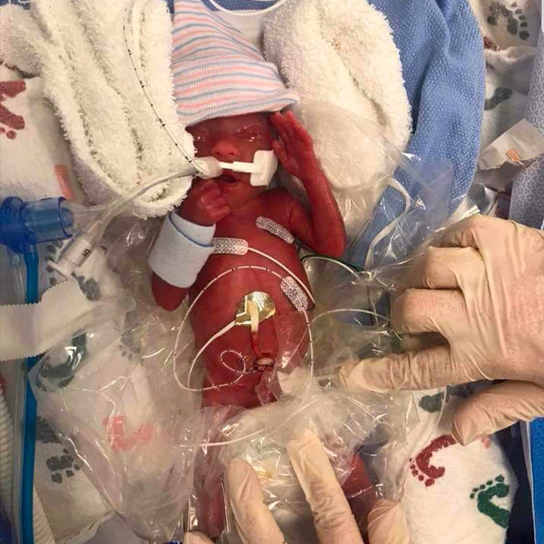 Hallie is registered to the contest to win money with this photo: baby, child, finger, hand, nail