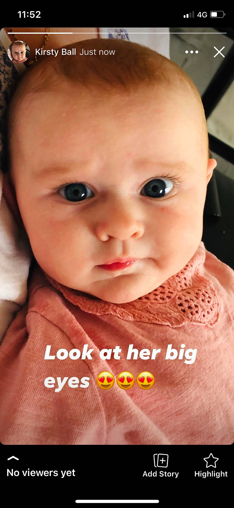 Ava-mae is registered to the contest to win money with this photo: baby, baby_making_funny_faces, cheek, child, chin, close_up, eye, eyebrow, face, facial_expression, forehead, head, lip, mouth, nose, person, photo_caption, photography, skin, smile