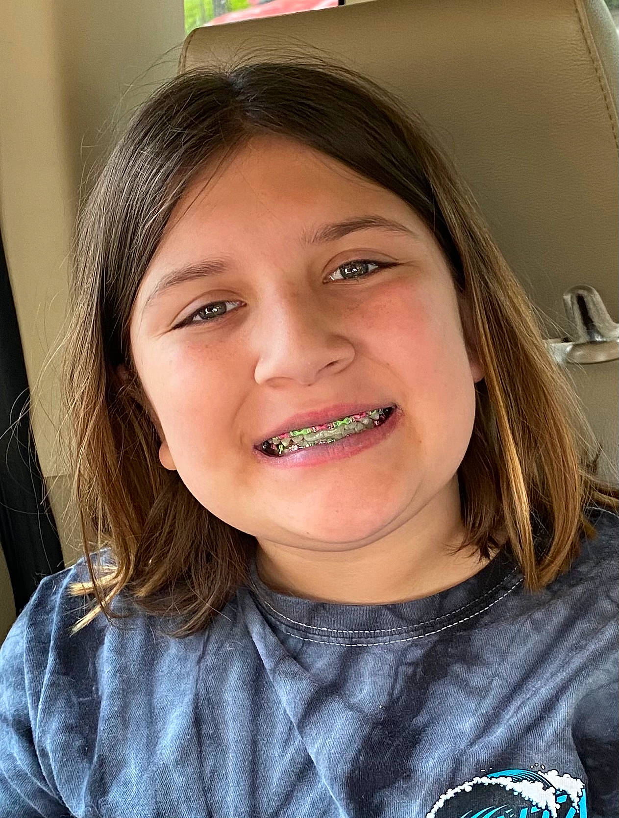 Amber is registered to the contest to win money with this photo: black_hair, cheek, chin, dental_braces, dentistry, eyebrow, eyelash, flash_photography, fun, happy, iris, jaw, joy, lip, lipstick, mouth, nose, person, skin, smile