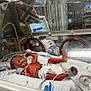 adult, architecture, baby, building, clothing, computerhardware, crib, electronics, face, furniture, hardware, head, hosiery, hospital, infantbed, male, man, monitor, person, sock