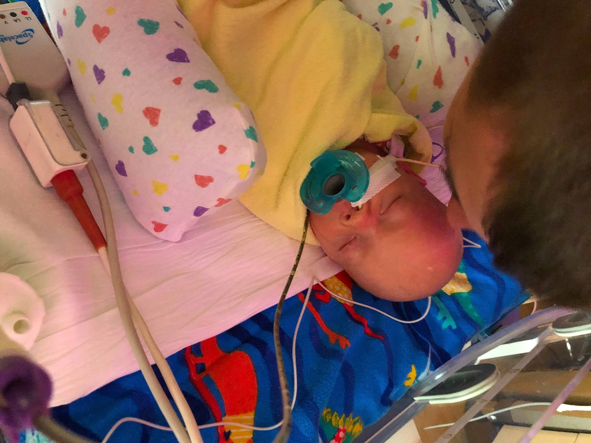 Flynn is registered to the contest to win money with this photo: baby, baby_products, child, comfort, event, eyewear, fun, hospital, leisure, linens, medical, medical_procedure, pattern, person, personal_protective_equipment, plastic, room, toddler, visual_arts