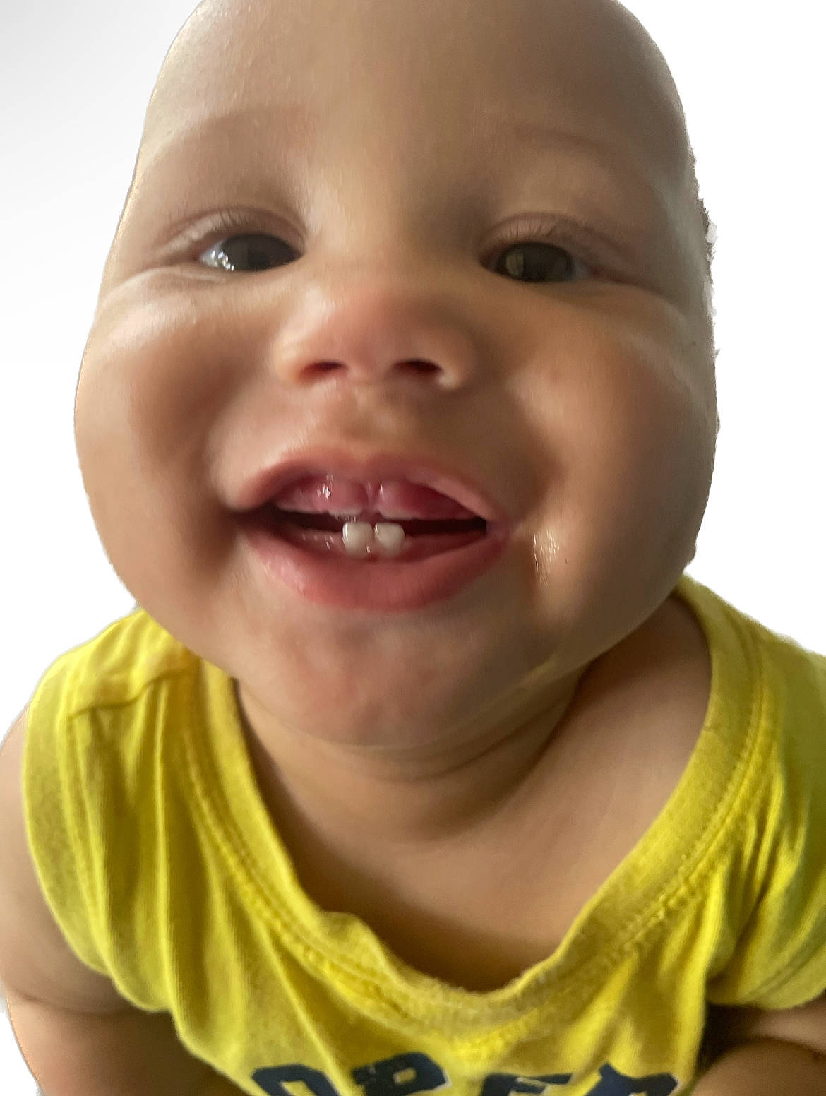 Raylon is registered to the contest to win money with this photo: baby, baby_laughing, cheek, child, close_up, eye, eyelash, fun, happy, iris, jaw, laugh, lip, mouth, nose, person, skin, smile, toddler, tongue
