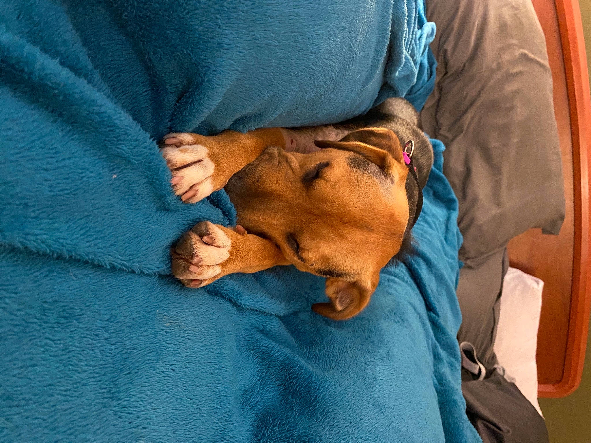 Breelyn is registered to the contest to win money with this photo: abdomen, claw, comfort, elbow, electric_blue, hand, human_body, human_leg, knee, linens, medical, medical_procedure, room, service, sitting, sleeve, thigh, vertebrate, wrinkle, wrist