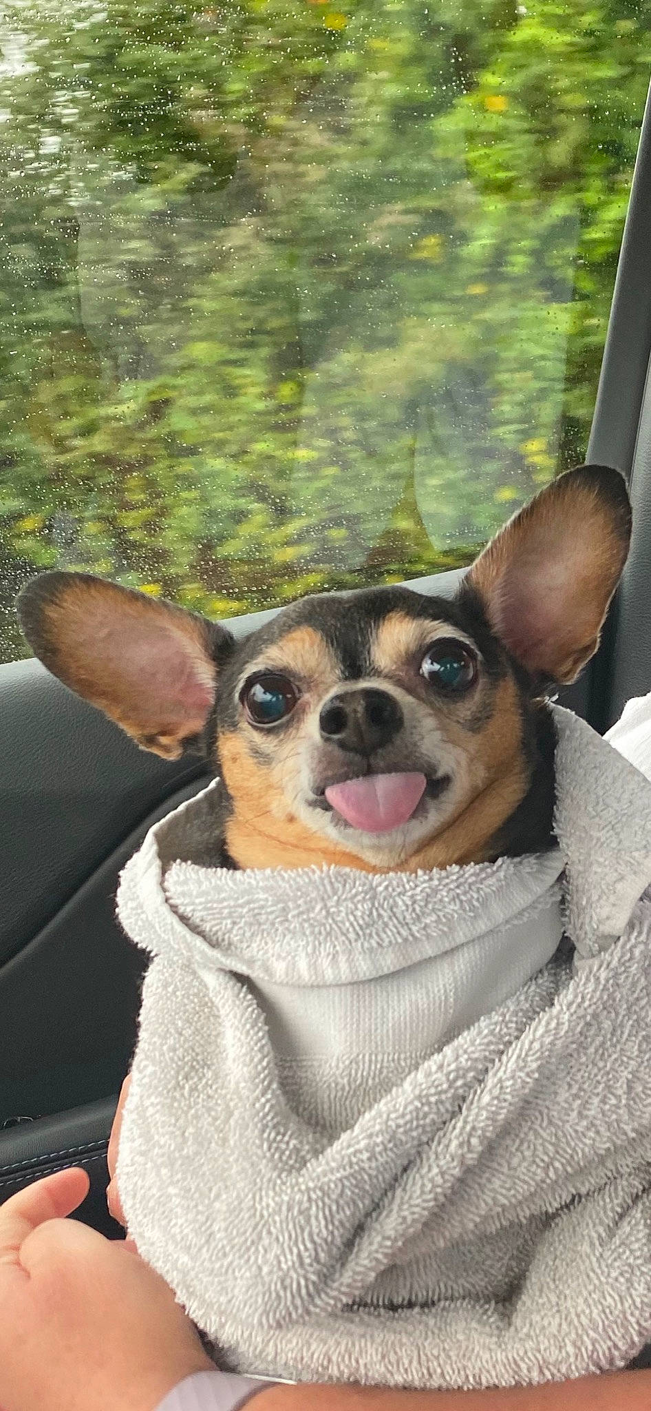 Radar