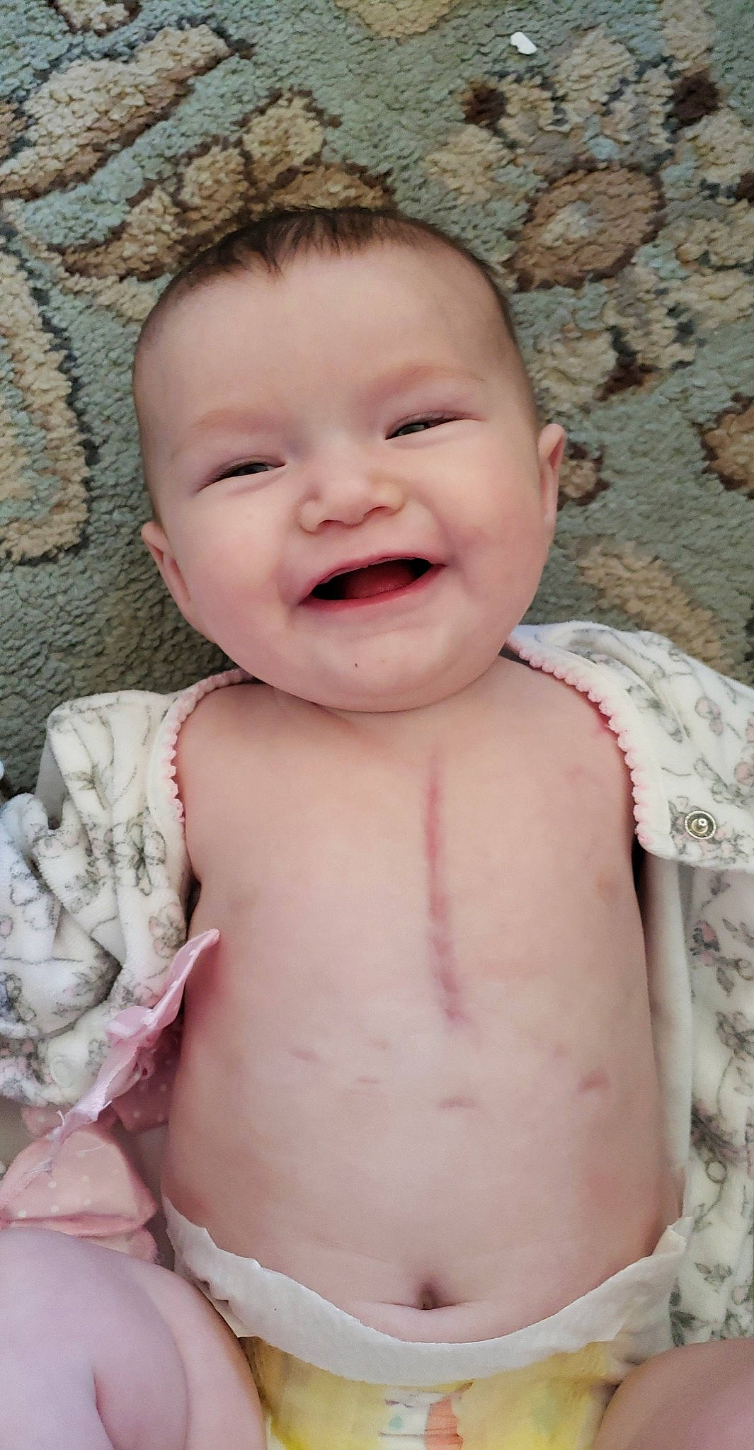 Myrah joined the competition — help win amazing prizes! baby, baby_laughing, baby_toddler_clothing, cheek, child, chin, eye, eyelash, facial_expression, happy, iris, joy, lip, mouth, nose, pattern, person, pink, skin, smile