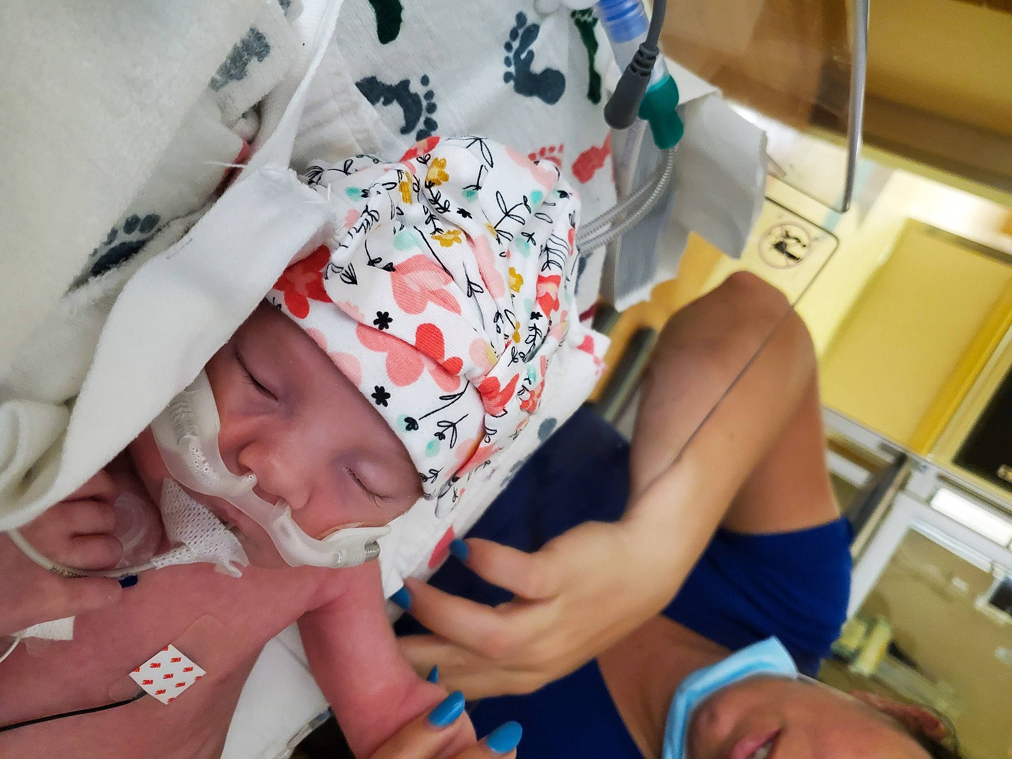 Cora is registered to the contest to win money with this photo: arm, baby, child, comfort, finger, fun, hand, headwear, health_care, human_leg, joint, knee, medical_procedure, mouth, nail, person, product, service, skin, thigh