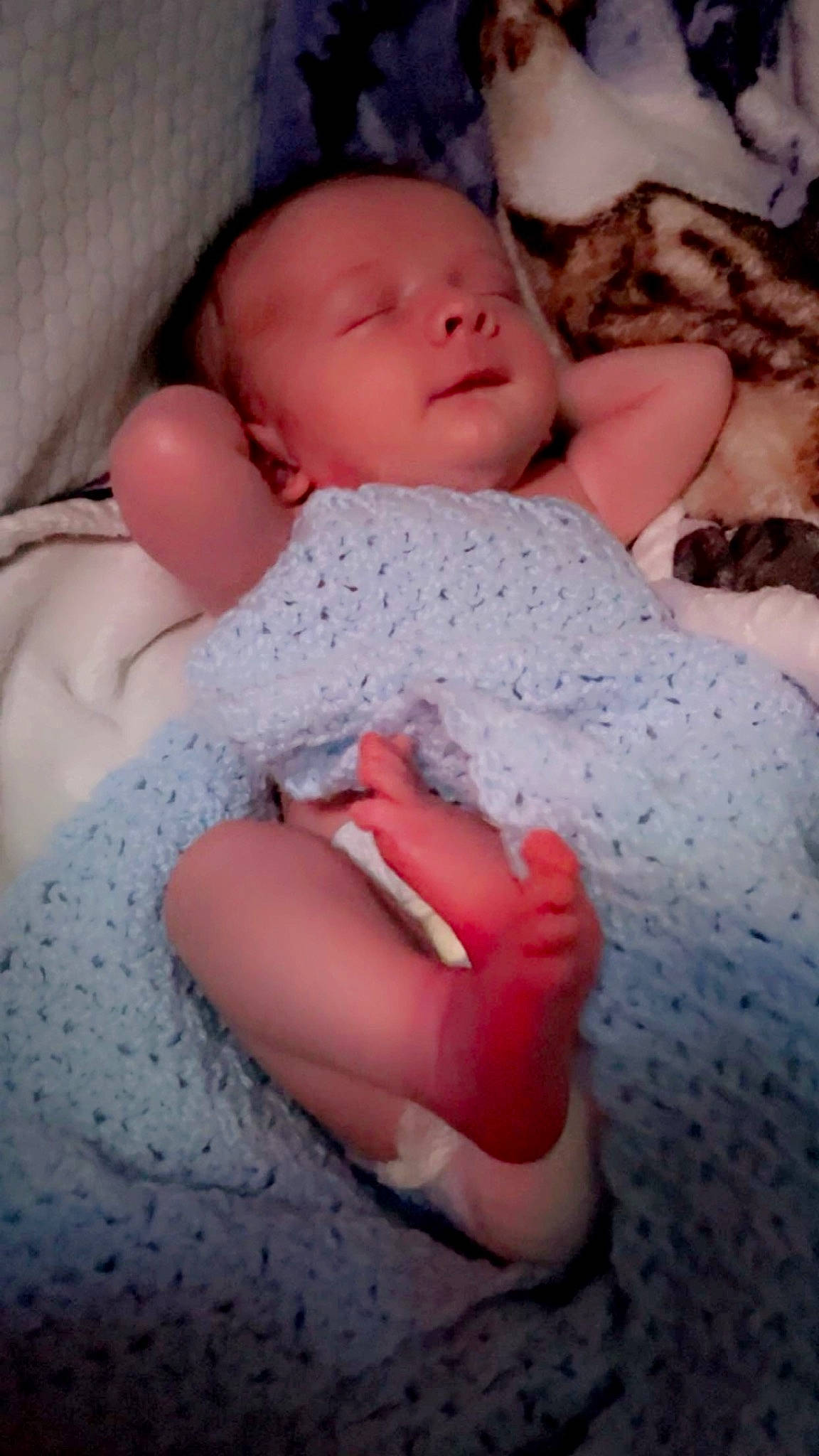 Lucas is registered to the contest to win money with this photo: abdomen, baby, baby_sleeping, baby_toddler_clothing, cheek, child, comfort, eye, eyelash, finger, human_leg, linens, lip, nail, pattern, person, pink, skin, thigh, thumb