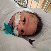 Brandyn Joseph Jr is registered to the contest to win money with this photo: newborn, baby, hospital, medical_equipment, nasal_cannula, blanket, bed, face, infant, patient, healthcare, tubes, curly_hair, lying_down, closeup, fragile, quiet, white, care, medical