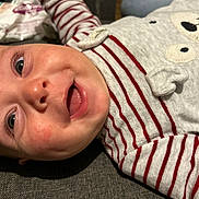 Tiago participe au concours pour gagner de l'argent avec cette photo : apparel, baby, child, closeup, cute, eyes, fabric, face, happy, indoor, infant, lying_down, mouth, onesie, person, skin, smile, soft_toys, striped_clothing, young