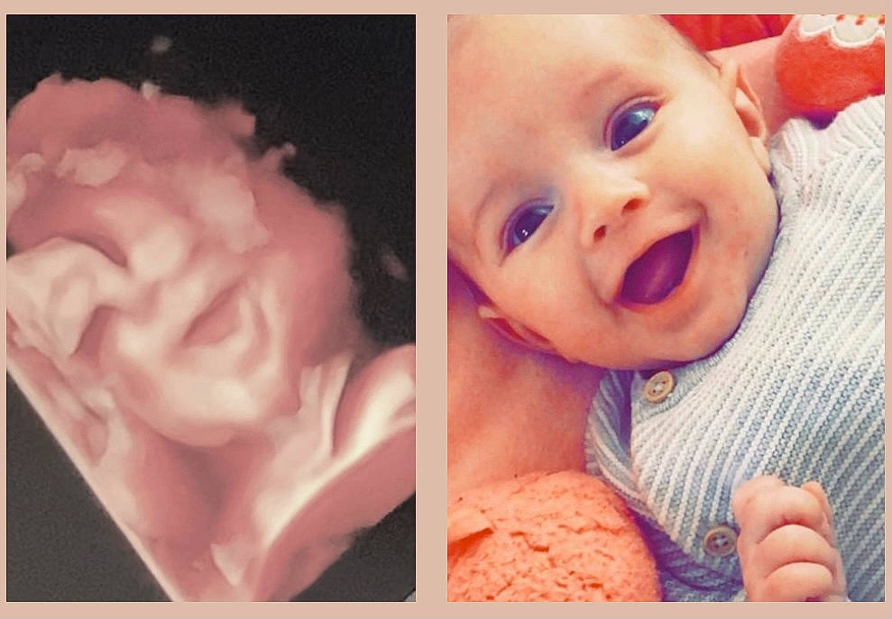 Lyo a rejoint le concours — aidez-le/la à gagner de superbes lots ! cheek, chin, ear, eyebrow, eyelash, face, finger, gesture, happy, iris, jaw, lip, mouth, neck, nose, organ, person, photograph, pink, skin