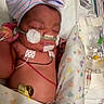 newborn, baby, sleeping, hospital, nicu, incubator, medical_equipment, monitoring, hat, striped_hat, blanket, heart_pattern, tubes, nasal_cannula, electrodes, premature_baby, portrait, infant, clinical, resting