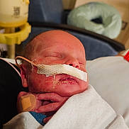 Freyja joined the competition — help win amazing prizes! baby, bed, blanket, care, closeup, face, feeding_tube, fragile, hand, healthcare, hospital, indoors, infant, medical_tape, newborn, patient, person, resting, skin, sleeping