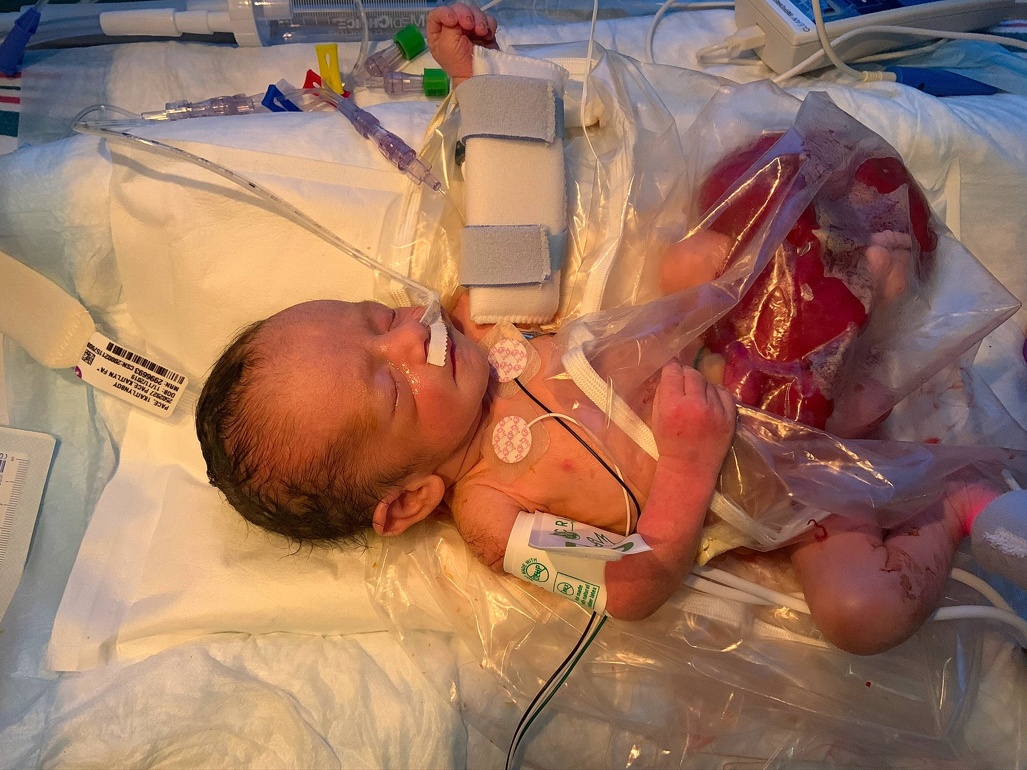 Scott joined the competition — help win amazing prizes! baby, birth, child, childbirth, hospital_bed, medical, medical_equipment, medical_procedure, operating_theater, patient, person, service
