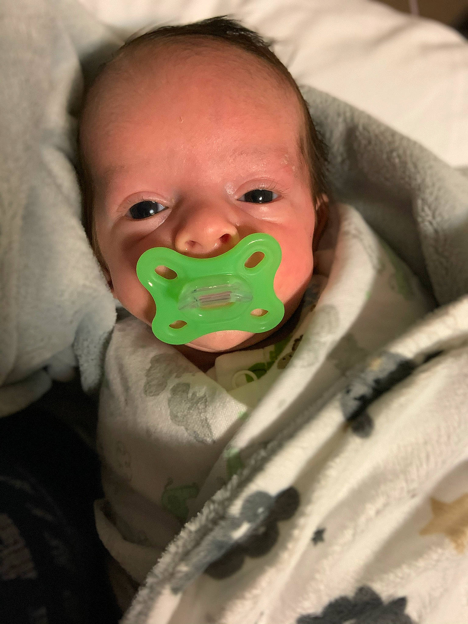 Scott joined the competition — help win amazing prizes! baby, cheek, child, chin, face, head, lip, mouth, nose, person, skin