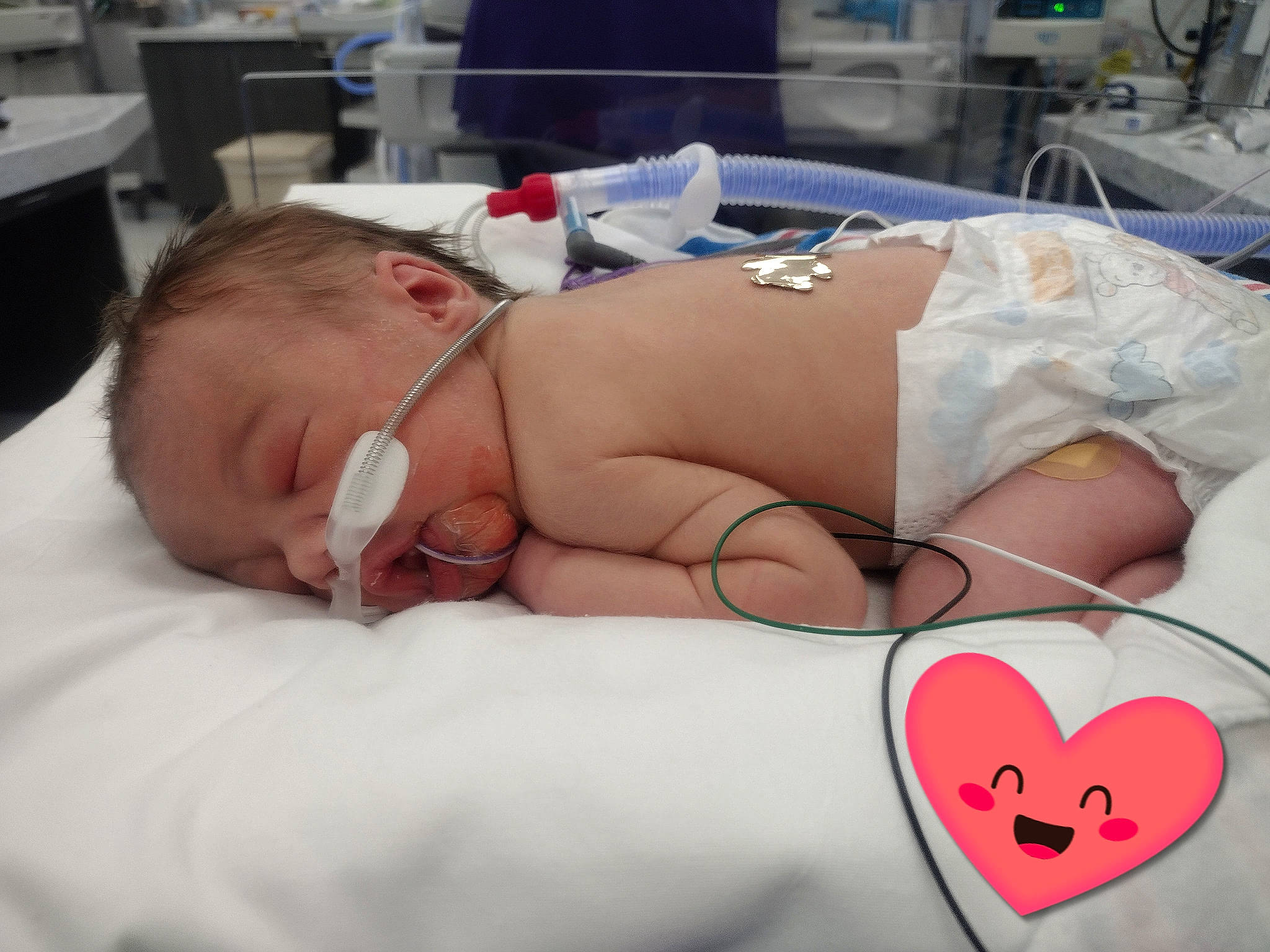 Ainsley is registered to the contest to win money with this photo: abdomen, baby, carmine, chest, child, comfort, event, finger, hospital, linens, mammal, medical, medical_equipment, medical_procedure, mouth, organ, patient, person, service, skin