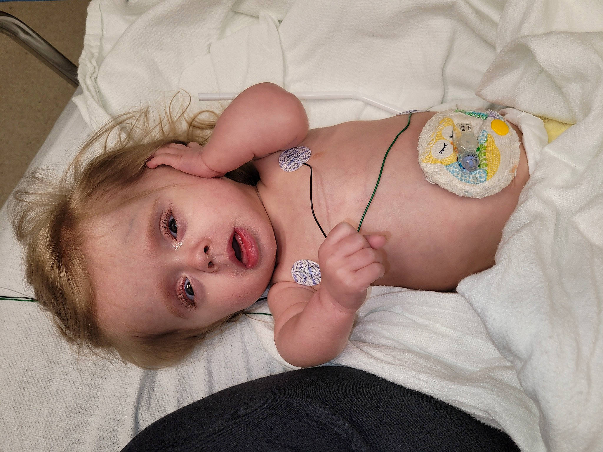 Bethany joined the competition — help win amazing prizes! abdomen, arm, baby, chest, comfort, eye, finger, glasses, hand, headgear, joint, mammal, mouth, neck, person, shoulder, skin, stomach, thigh, toddler