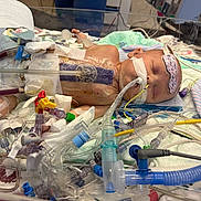 Roseanna is registered to the contest to win money with this photo: baby, face, fragile, healthcare, hospital, hospital_bed, incubator, infant, intensive_care, life_support, medical_equipment, medical_tape, monitoring, neonate, newborn, patient, premature, respirator, sleeping, tubes