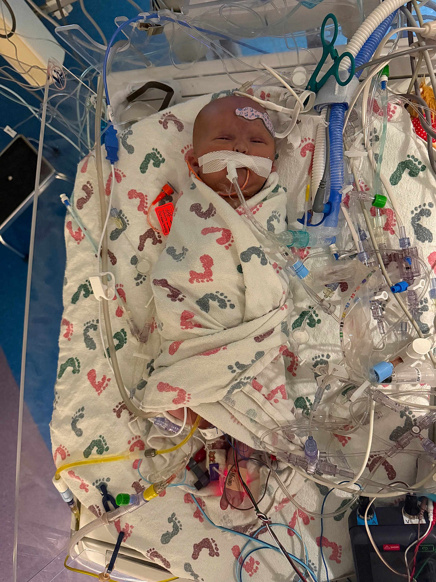 Roseanna joined the competition — help win amazing prizes! infant, baby, hospital, medical_equipment, incubator, blanket, footprints, tube, wire, sensor, breathing_tube, neonatal_care, patient, swaddled, premature_baby, medical_care, healthcare, intensive_care, bed, monitoring