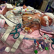 Roseanna joined the competition — help win amazing prizes! infant, baby, hospital, medical_equipment, tubes, monitor, bed, blanket, hat, flower, patient, healthcare, newborn, cute, resting, pink, clothing, person, care, life_support