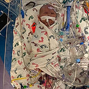 Roseanna is registered to the contest to win money with this photo: infant, baby, hospital, medical_equipment, incubator, blanket, footprints, tube, wire, sensor, breathing_tube, neonatal_care, patient, swaddled, premature_baby, medical_care, healthcare, intensive_care, bed, monitoring