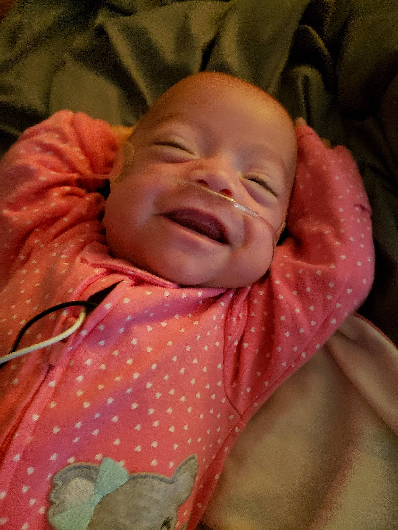 Joselyn is registered to the contest to win money with this photo: baby, bedtime, birth, cheek, child, childbirth, face, facial_expression, head, laugh, lip, mouth, nose, person, skin, sleep, smile, wrinkle