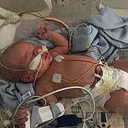 Isabella joined the competition — help win amazing prizes! newborn, baby, incubator, hospital, medical_equipment, wires, blanket, diaper, monitoring_pads, sleeping, infant, healthcare, patient, tiny, cute, fragile, medical_care, tubes, resting, premature