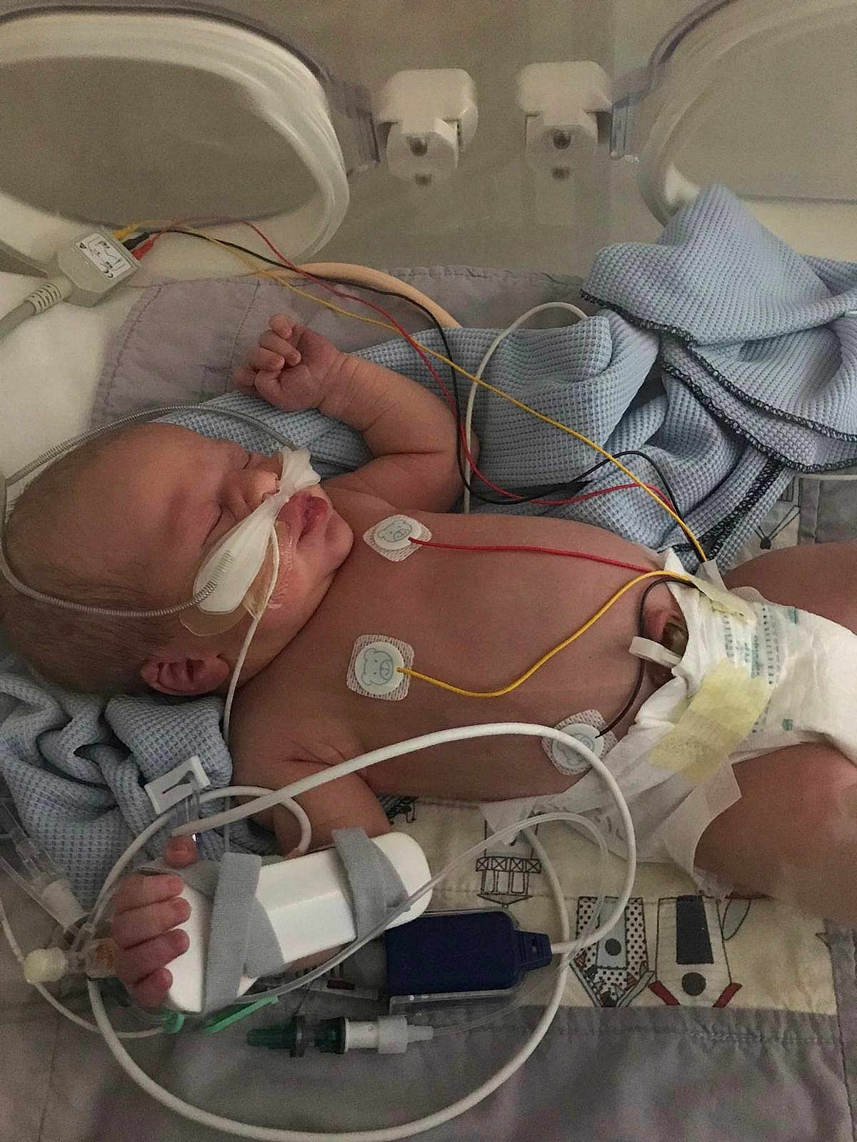 Isabella joined the competition — help win amazing prizes! newborn, baby, incubator, hospital, medical_equipment, wires, blanket, diaper, monitoring_pads, sleeping, infant, healthcare, patient, tiny, cute, fragile, medical_care, tubes, resting, premature