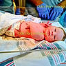 newborn, baby, infant, hospital, medical, delivery_room, warming_bed, blanket, swaddling, gloves, healthcare_worker, birth, portrait, lying_down, face, eyes_open, hospital_bedding, clinical, photography, text_overlay