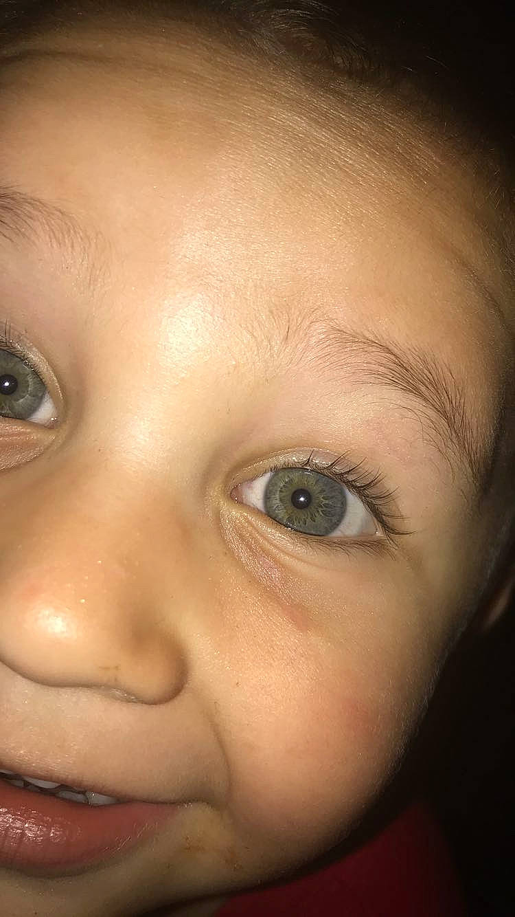 Caesar joined the competition — help win amazing prizes! cheek, child, chin, close_up, eye, eyebrow, eyelash, face, forehead, head, iris, jaw, lip, mouth, nose, organ, person, photography, portrait_photography, skin