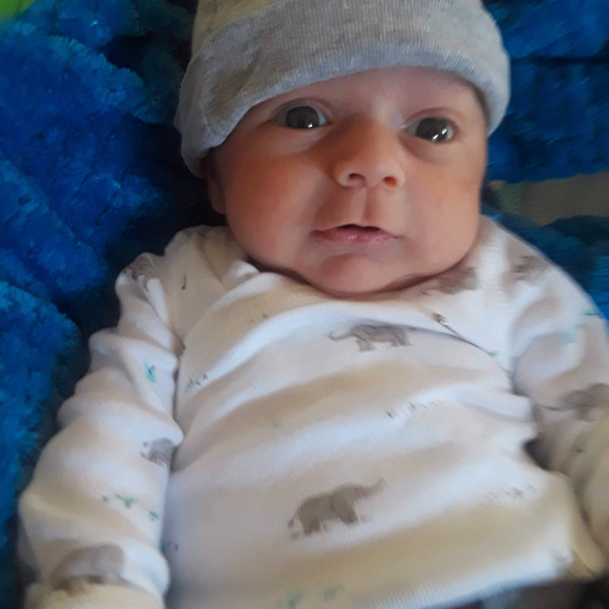 Johnathon is registered to the contest to win money with this photo: baby, bonnet, cheek, child, chin, eye, face, forehead, head, headgear, nose, person, skin, toddler