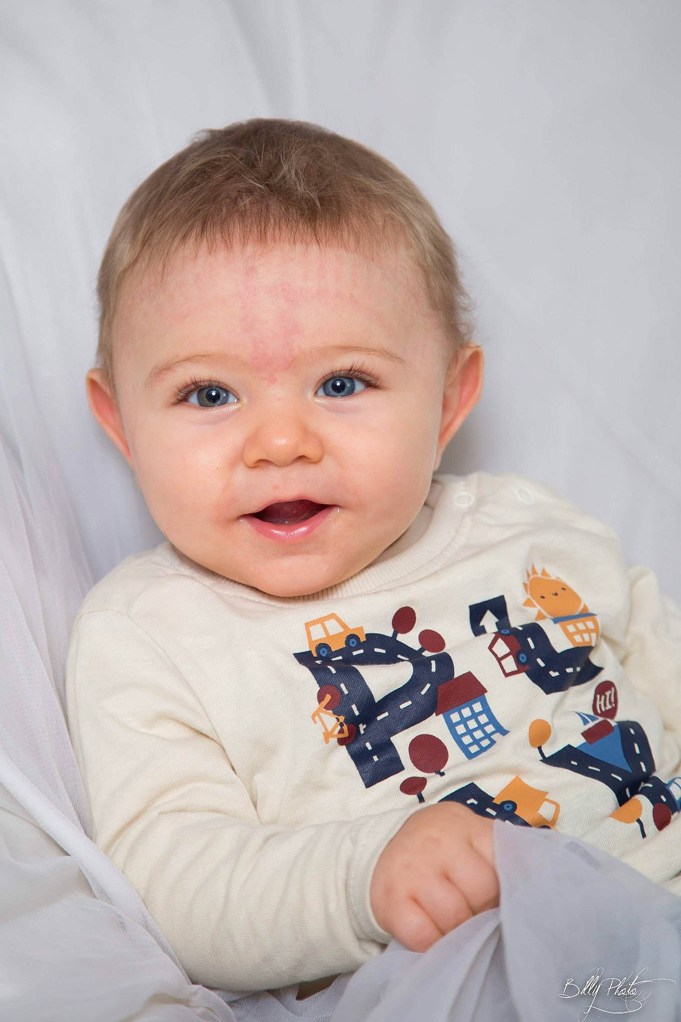 énael a rejoint le concours — aidez-le/la à gagner de superbes lots ! baby, baby_toddler_clothing, cheek, child, eye, face, finger, head, person, photography, portrait_photography, skin, sleeve, toddler