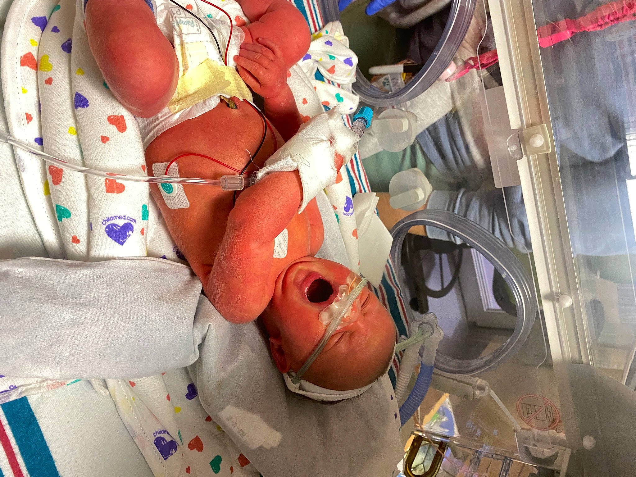 Harper joined the competition — help win amazing prizes! auto_part, baby, baby_products, chest, child, event, hat, headgear, health_care, human_leg, machine, medical, medical_equipment, medical_procedure, motor_vehicle, pattern, person, personal_protective_equipment, plastic, room