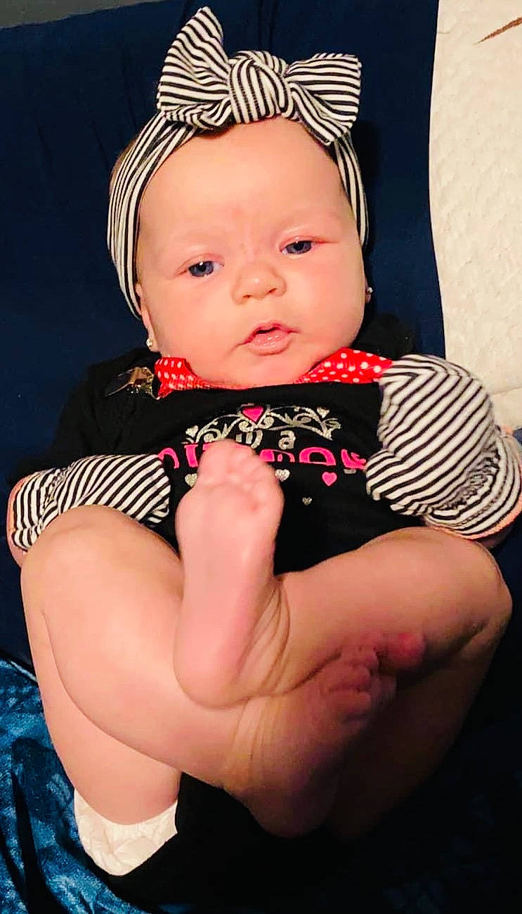 Reeslyn is registered to the contest to win money with this photo: arm, baby, baby_toddler_clothing, cheek, dress, eye, eyebrow, finger, flash_photography, hair, hairstyle, hand, headwear, human_body, iris, leg, lip, neck, organ, person