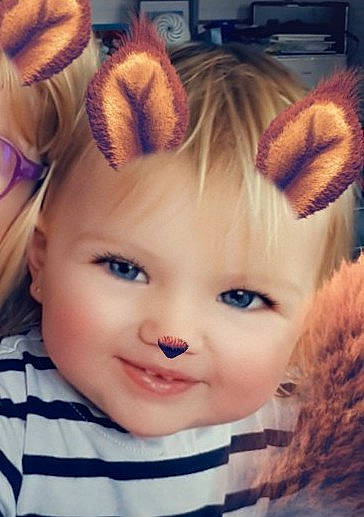 Andrea participe au concours pour gagner de l'argent avec cette photo : cheek, child, ear, eye, eyebrow, face, forehead, fur, hair, hair_accessory, hair_coloring, head, human_hair_color, infant, iris, nose, person, product, skin, snout
