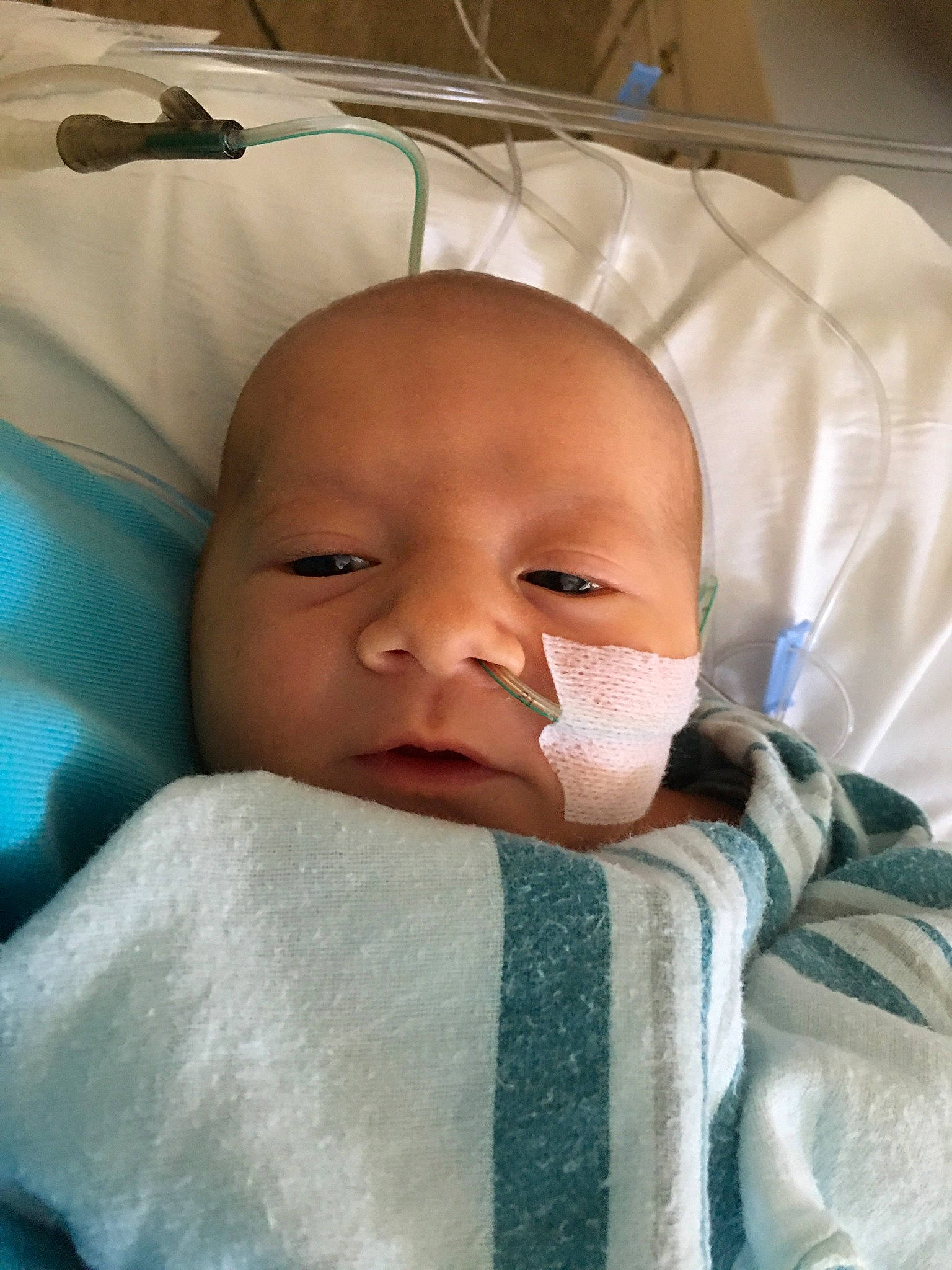 Remi is registered to the contest to win money with this photo: baby, bedtime, birth, cheek, child, childbirth, eye, face, head, lip, mouth, nose, person, skin, toddler