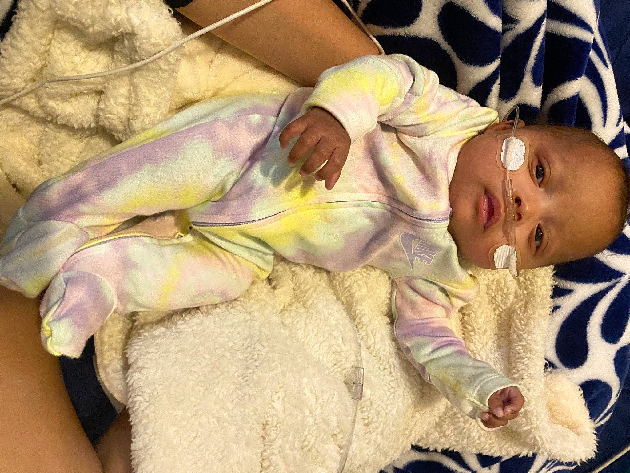 Kataleya is registered to the contest to win money with this photo: abdomen, baby, baby_products, baby_toddler_clothing, bedding, bedtime, cheek, chest, child, comfort, eye, head, human_body, linens, nap, pattern, person, room, sleep, thumb