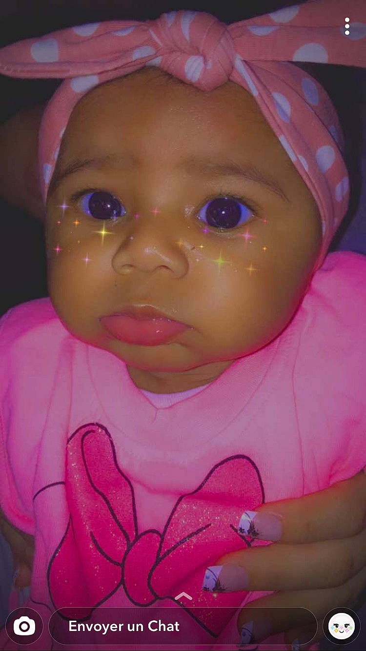 Kéya a rejoint le concours — aidez-le/la à gagner de superbes lots ! baby, cheek, child, eye, eyebrow, eyelash, face, forehead, head, headwear, iris, lip, magenta, mouth, nose, person, pink, skin, smile, toddler