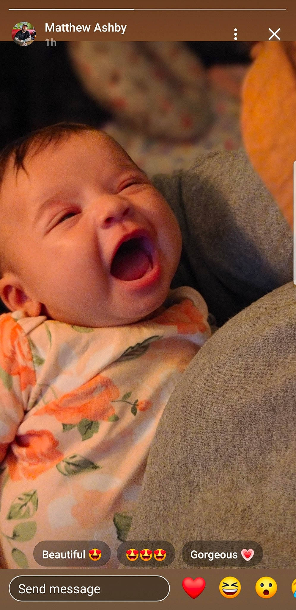 Malia is registered to the contest to win money with this photo: baby, cheek, comfort, ear, eye, eyebrow, forehead, gesture, happy, human_body, iris, jaw, lip, mouth, neck, nose, person, skin, sleeve, toddler