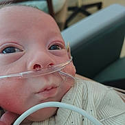 Koda is registered to the contest to win money with this photo: baby, infant, face, nasal_cannula, oxygen_tube, hospital, medical_equipment, close_up, skin, clothing, person, young_child, sweater, indoors, healthcare, patient, resting, cute, newborn, care