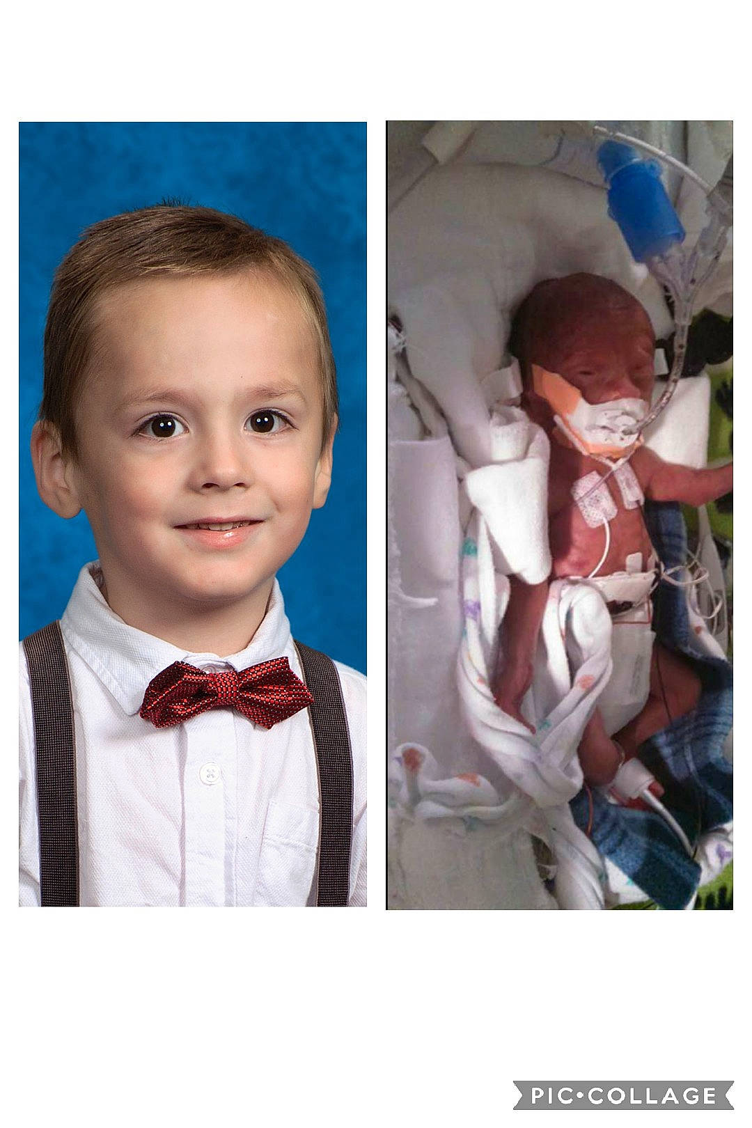 Quinton is registered to the contest to win money with this photo: bow_tie, cheek, child, child_model, collage, ear, facial_expression, fashion_accessory, formal_wear, head, human, neck, person, photograph, photography, photomontage, portrait, smile, stock_photography, tie