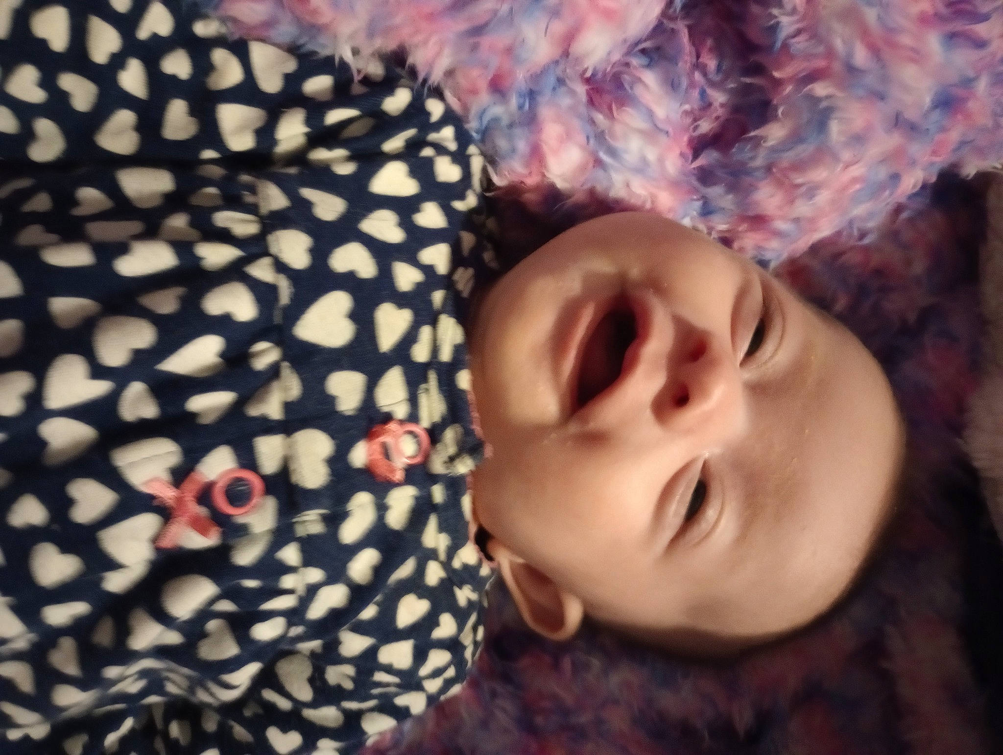 Ellie joined the competition — help win amazing prizes! baby, beauty, cheek, child, eyelash, fashion_accessory, fun, grass, happy, mammal, nose, pattern, person, portrait_photography, sky, textile, toddler, tree, vertebrate, wood