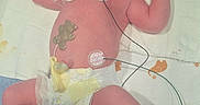 Emerley is registered to the contest to win money with this photo: newborn, baby, hospital, diaper, hat, monitoring, sensors, wires, bed, blanket, elephant_print, medical, resting, infant, cute, sleeping, person, skin, healthcare, tiny